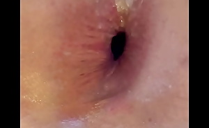 Ass hole farts gape