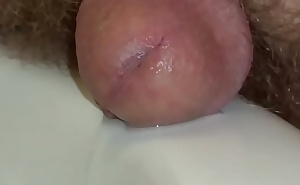 Extreme Pisshole Closeup 2015 Prying It Open Peering Down Deep Seeing Folds Of Urethral Skin