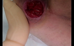 Deep fucking rosebud with fucking machine