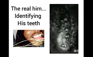 Identifying his teeth trivia(the real him pt2)