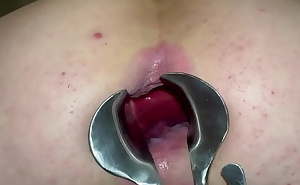 Gaping my ass with my speculum